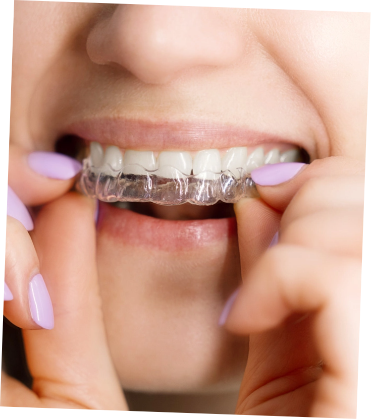 aligner_badreichenhall_boettcher_mundart@2x