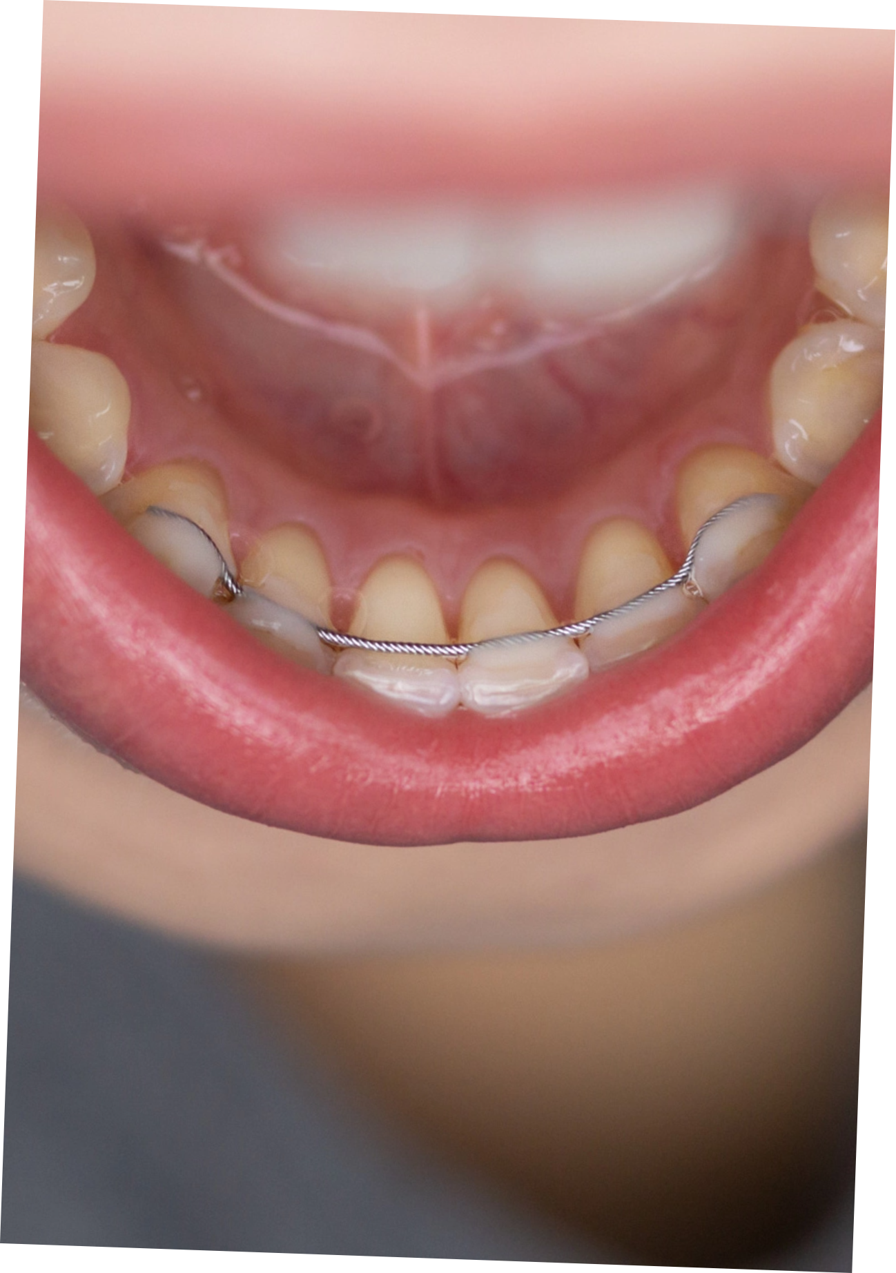 retainer_kfo_boettcher_badreichenhall@2x